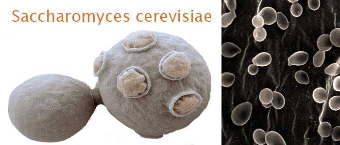 Saccharomyces cerevisiae morphology